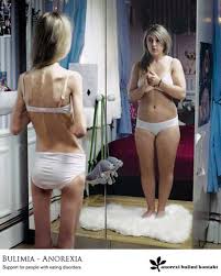 Anorexia y Bulimia: Sabes cómo piensan y se ven las anorexicas?